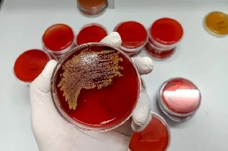 Básico em Bacteriologia Clínica