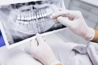 imagem Básico em Endodontia