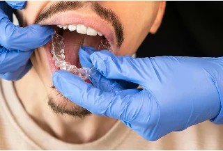 imagem Básico em Odontologia Estética